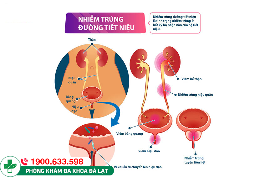 Hình ảnh minh họa